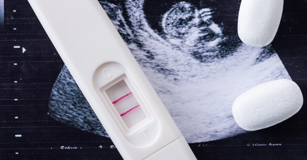 Werden schwanger man mit nach mifegyne wieder abtreibung kann einer Kann man