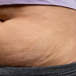 Bauch nach der Schwangerschaft: So sieht er wirklich aus & wann er sich zurückbildet