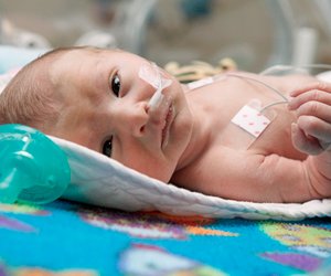 WHO warnt: Frühgeborene Babys nicht von Müttern mit Corona trennen