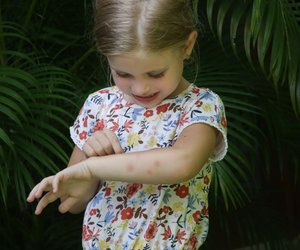 Insektenstichheiler-Test bei Stiftung Warentest: Das sind die 3 Sieger