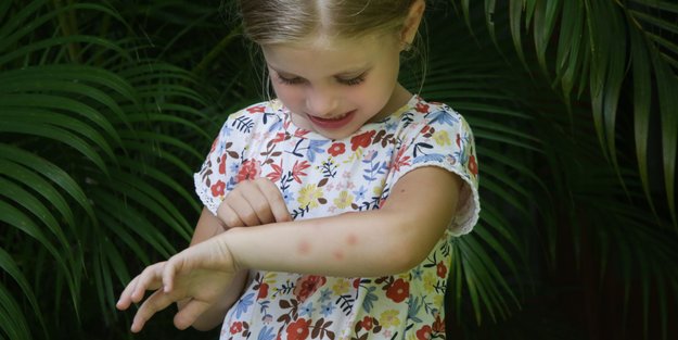 Insektenstichheiler-Test bei Stiftung Warentest: Das sind die 3 Sieger