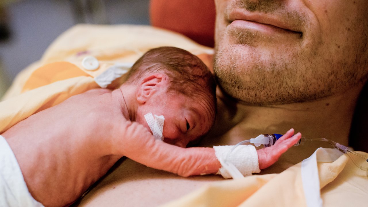 Premature baby born in the 28th week of pregnancy lies on Papa's chest and raises one hand