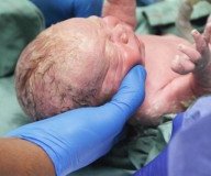Dieses Baby wurde zweimal geboren