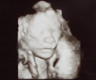 Die 22. Woche schwanger: Junge oder Mädchen?