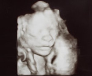 Die 22. Woche schwanger: Junge oder Mädchen?