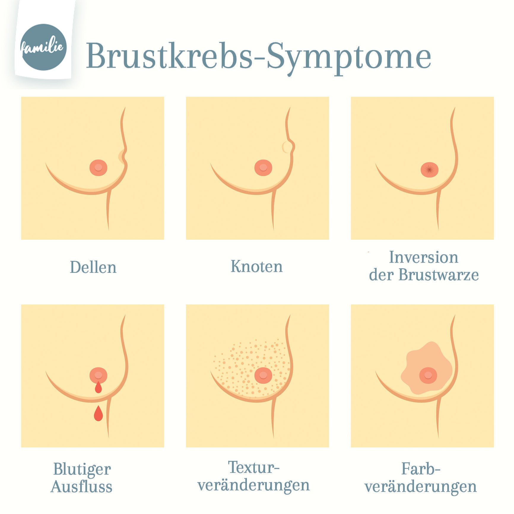 Brustkrebs Symptome Familie.de