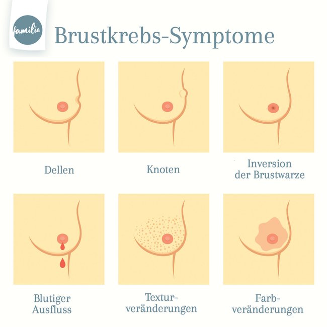 Brustkrebs Symptome Familie.de